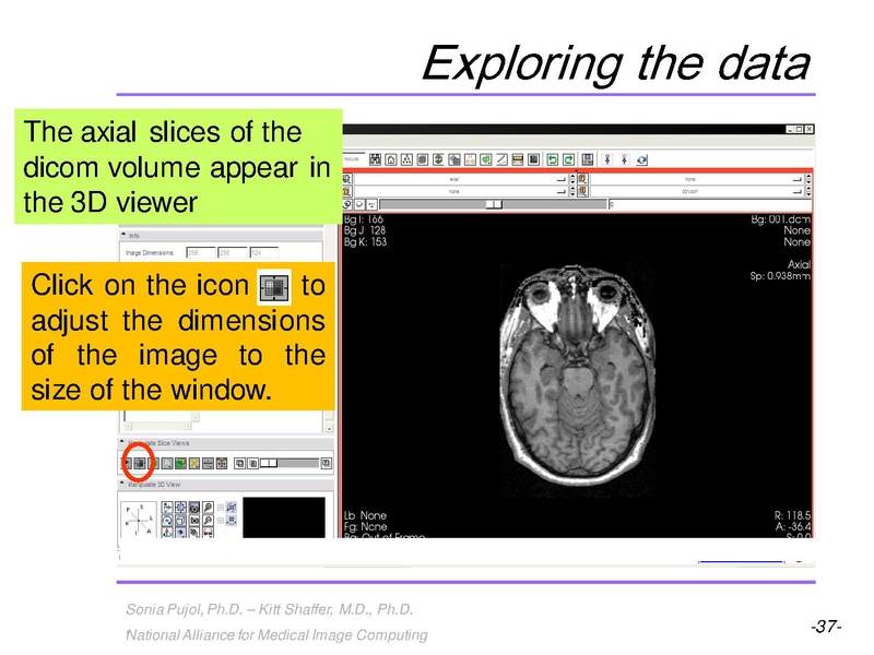 File:3DVisualization SoniaPujol RSNA2009 11-30-2009.pdf