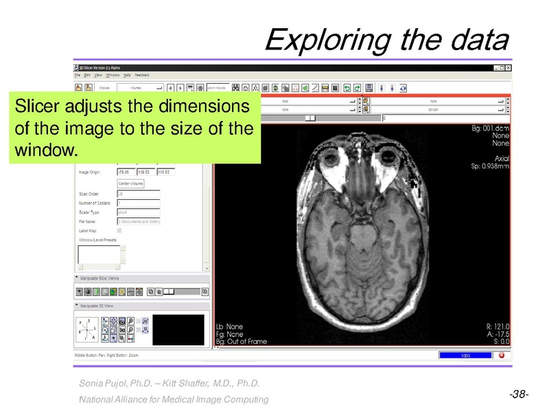 File:3DVisualization SoniaPujol RSNA2009 11-30-2009.pdf