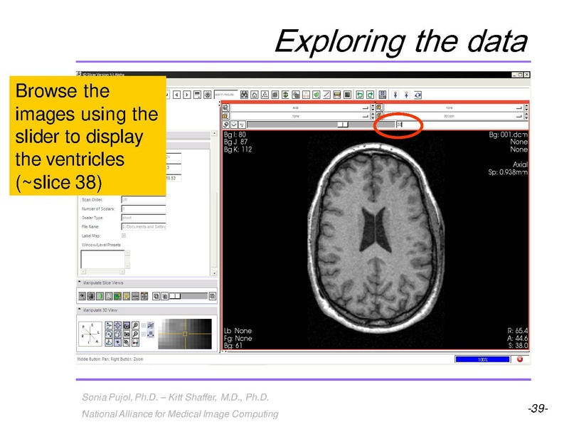 File:3DVisualization SoniaPujol RSNA2009 11-30-2009.pdf