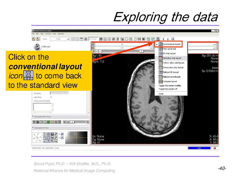 File:3DVisualization SoniaPujol RSNA2009 11-30-2009.pdf