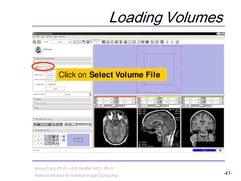File:3DVisualization SoniaPujol RSNA2009 11-30-2009.pdf