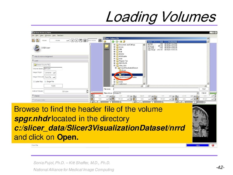 File:3DVisualization SoniaPujol RSNA2009 11-30-2009.pdf