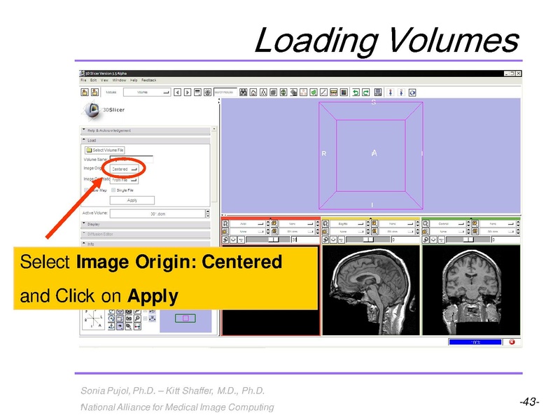 File:3DVisualization SoniaPujol RSNA2009 11-30-2009.pdf