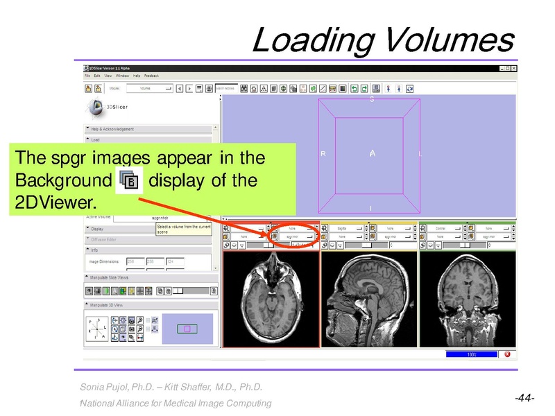 File:3DVisualization SoniaPujol RSNA2009 11-30-2009.pdf