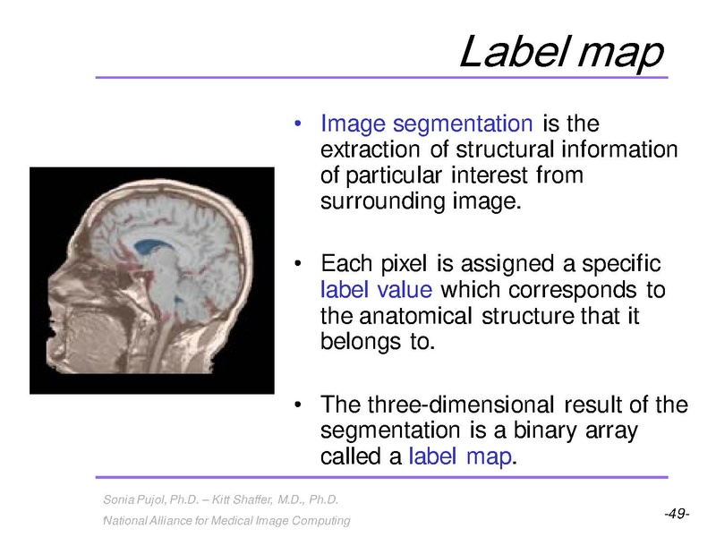 File:3DVisualization SoniaPujol RSNA2009 11-30-2009.pdf