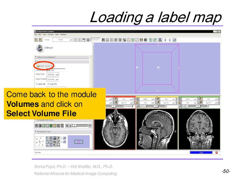 File:3DVisualization SoniaPujol RSNA2009 11-30-2009.pdf