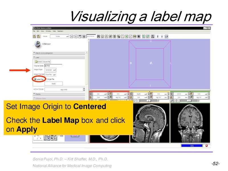 File:3DVisualization SoniaPujol RSNA2009 11-30-2009.pdf