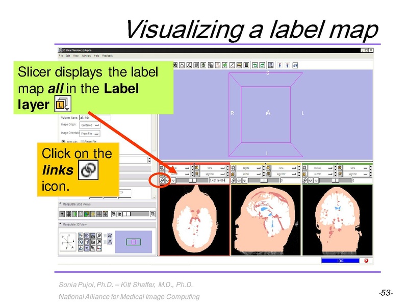 File:3DVisualization SoniaPujol RSNA2009 11-30-2009.pdf