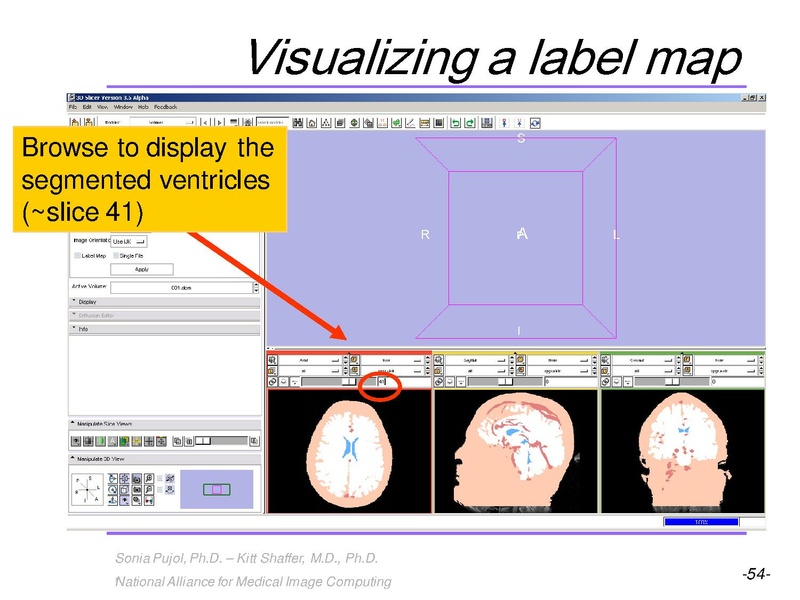 File:3DVisualization SoniaPujol RSNA2009 11-30-2009.pdf