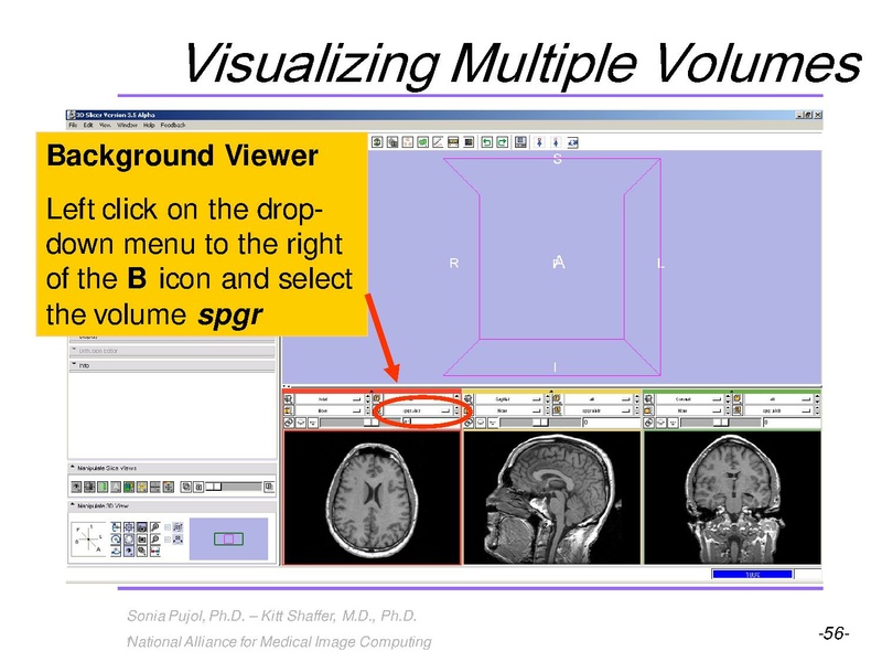 File:3DVisualization SoniaPujol RSNA2009 11-30-2009.pdf