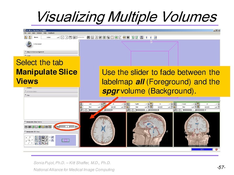 File:3DVisualization SoniaPujol RSNA2009 11-30-2009.pdf