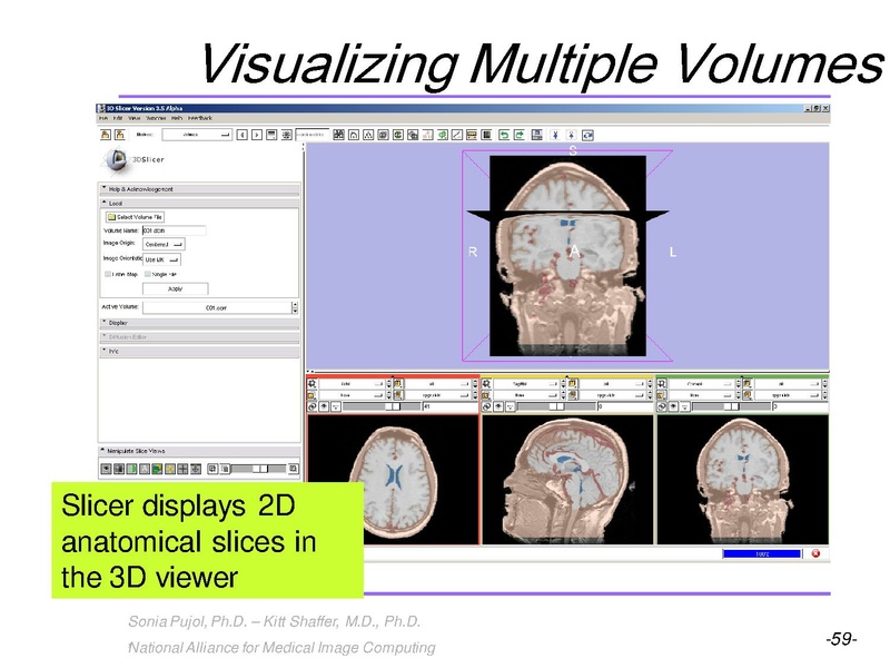 File:3DVisualization SoniaPujol RSNA2009 11-30-2009.pdf