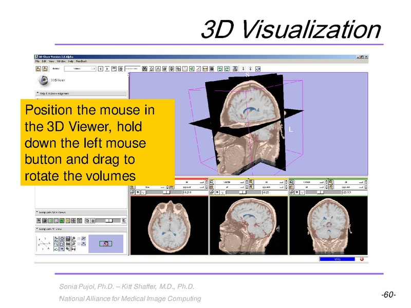 File:3DVisualization SoniaPujol RSNA2009 11-30-2009.pdf