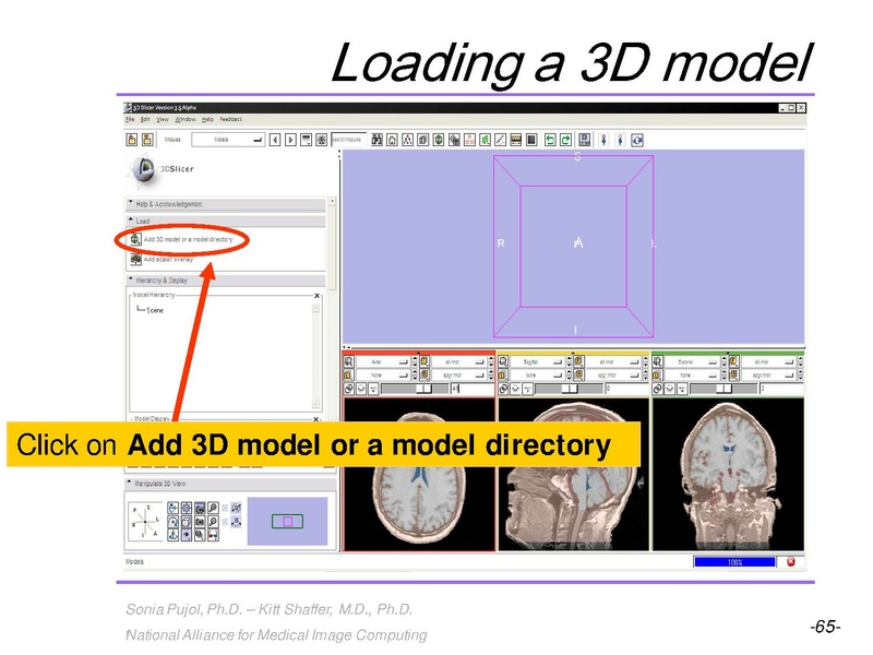 File:3DVisualization SoniaPujol RSNA2009 11-30-2009.pdf