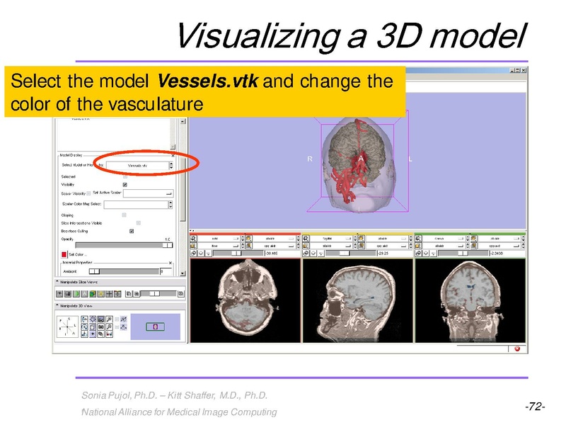 File:3DVisualization SoniaPujol RSNA2009 11-30-2009.pdf