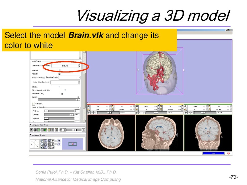 File:3DVisualization SoniaPujol RSNA2009 11-30-2009.pdf