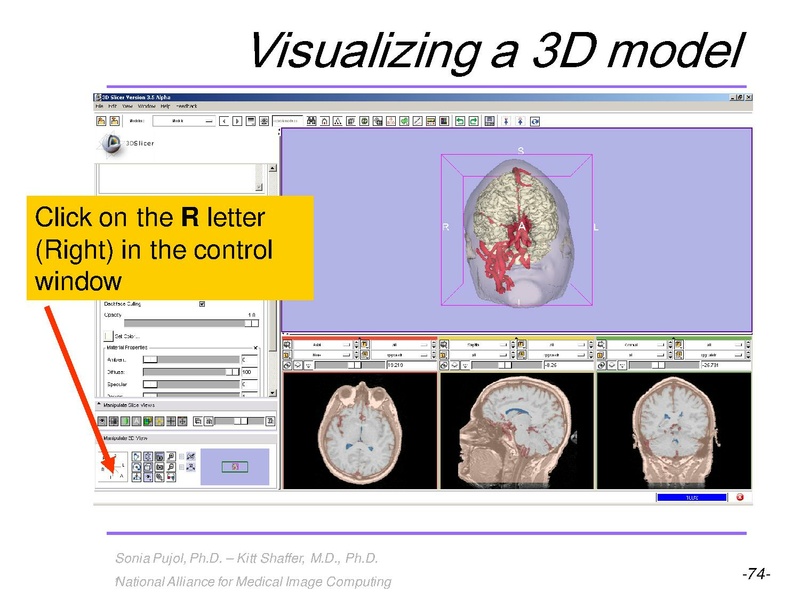 File:3DVisualization SoniaPujol RSNA2009 11-30-2009.pdf