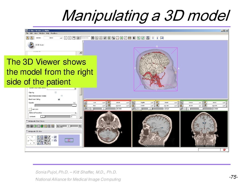 File:3DVisualization SoniaPujol RSNA2009 11-30-2009.pdf