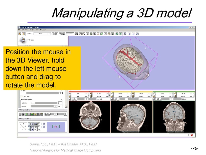 File:3DVisualization SoniaPujol RSNA2009 11-30-2009.pdf