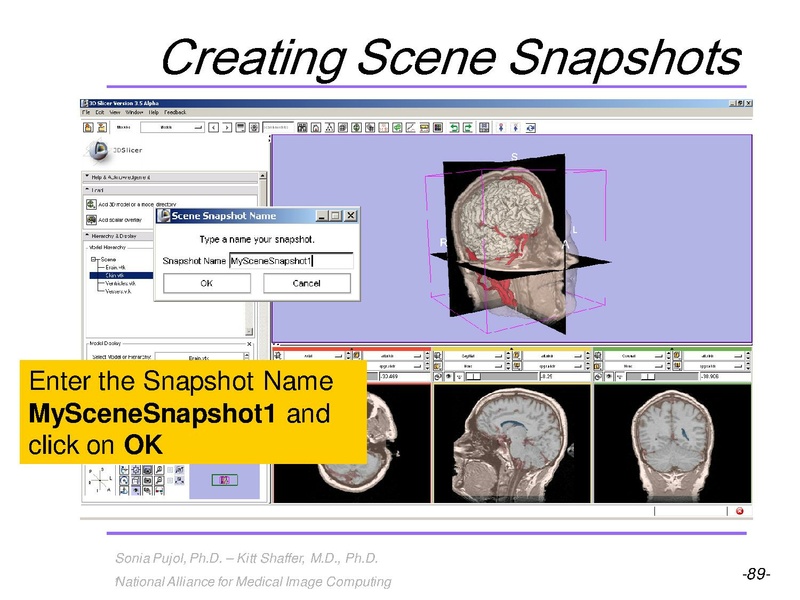 File:3DVisualization SoniaPujol RSNA2009 11-30-2009.pdf