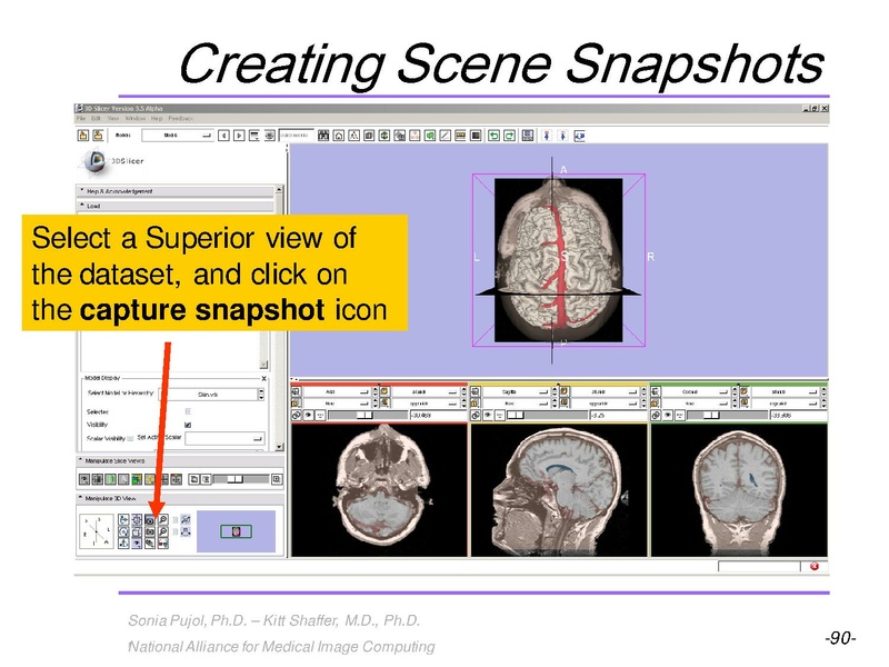 File:3DVisualization SoniaPujol RSNA2009 11-30-2009.pdf