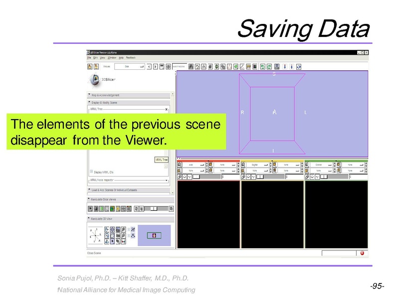 File:3DVisualization SoniaPujol RSNA2009 11-30-2009.pdf