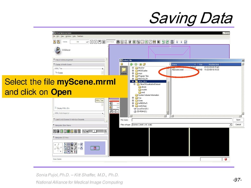 File:3DVisualization SoniaPujol RSNA2009 11-30-2009.pdf