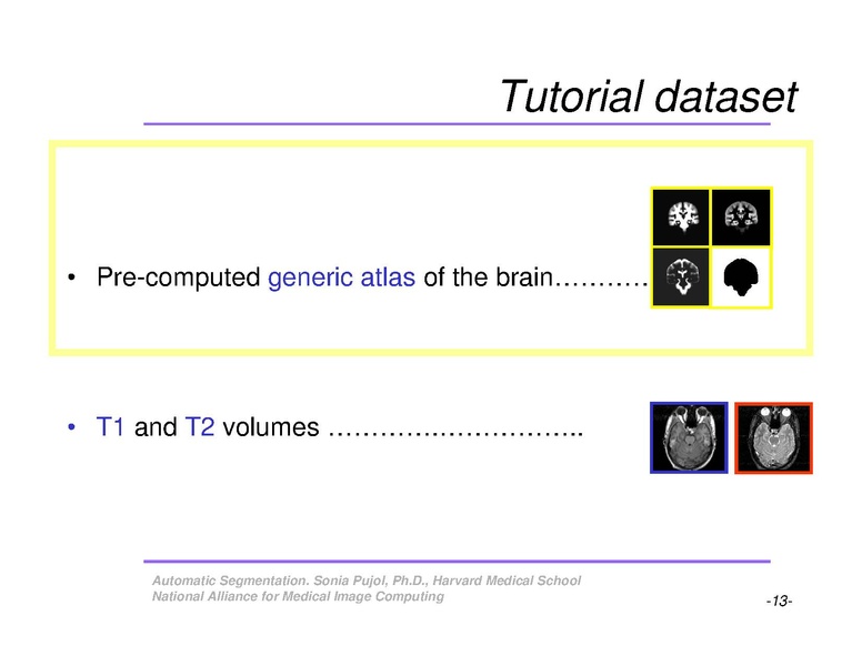 File:AutomaticSegmentation SoniaPujol.pdf
