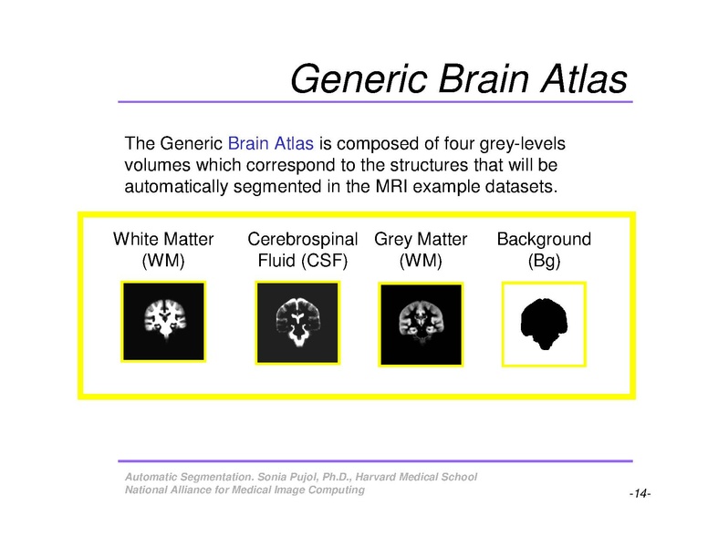 File:AutomaticSegmentation SoniaPujol.pdf