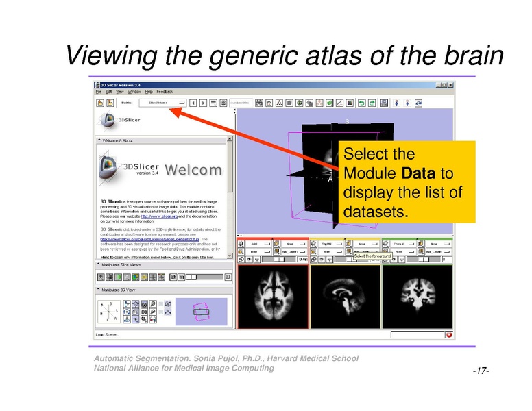 File:AutomaticSegmentation SoniaPujol.pdf