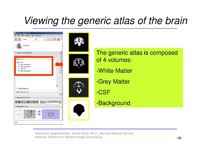 File:AutomaticSegmentation SoniaPujol.pdf