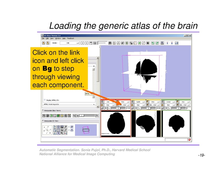 File:AutomaticSegmentation SoniaPujol.pdf