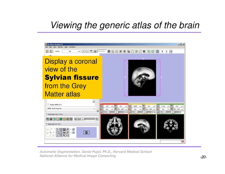 File:AutomaticSegmentation SoniaPujol.pdf