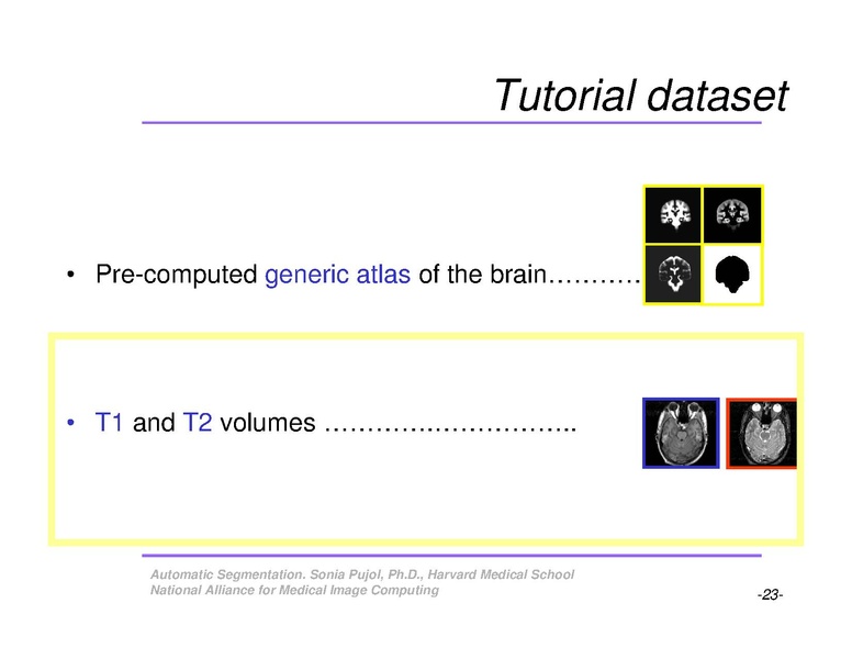 File:AutomaticSegmentation SoniaPujol.pdf