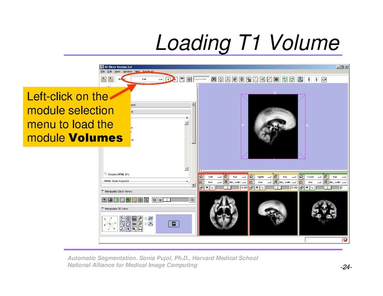 File:AutomaticSegmentation SoniaPujol.pdf
