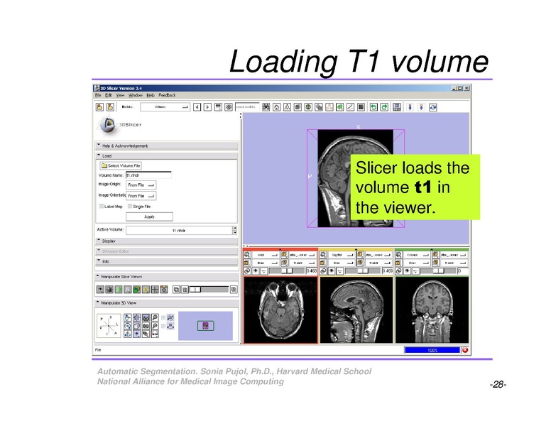 File:AutomaticSegmentation SoniaPujol.pdf