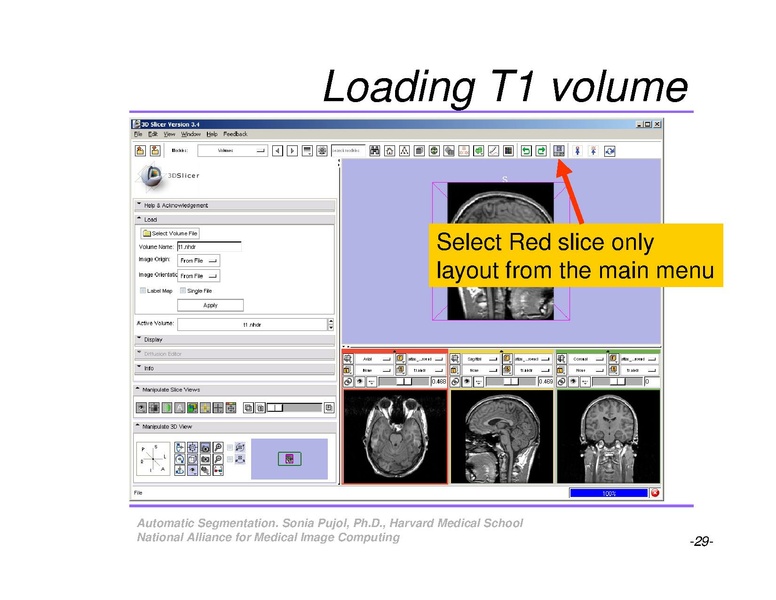 File:AutomaticSegmentation SoniaPujol.pdf