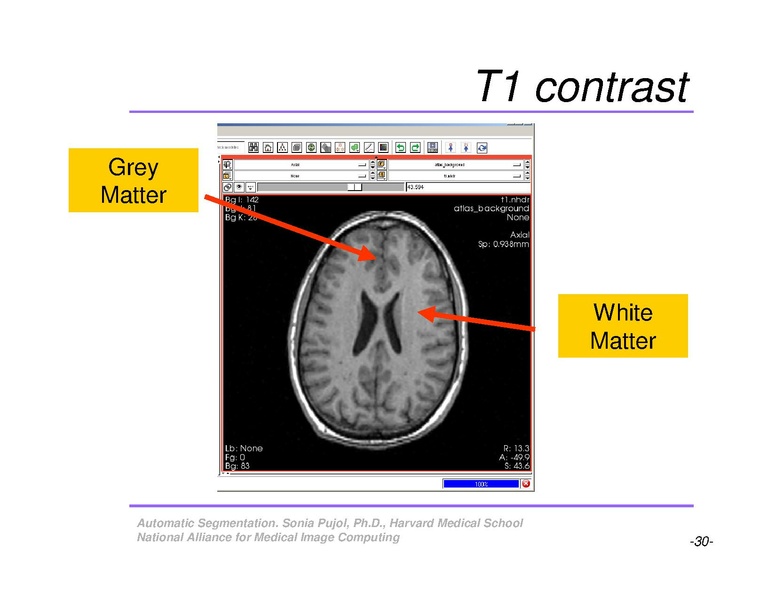 File:AutomaticSegmentation SoniaPujol.pdf