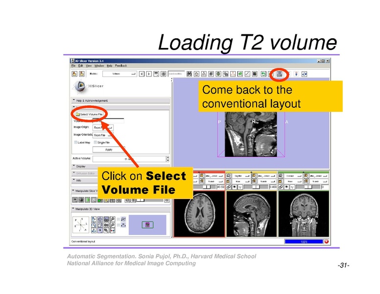 File:AutomaticSegmentation SoniaPujol.pdf