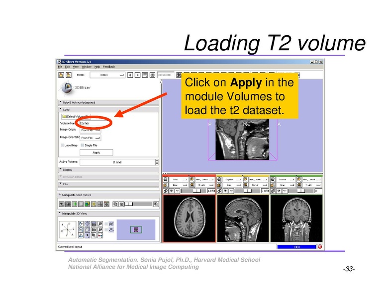 File:AutomaticSegmentation SoniaPujol.pdf