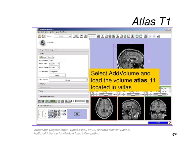 File:AutomaticSegmentation SoniaPujol.pdf