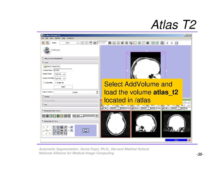 File:AutomaticSegmentation SoniaPujol.pdf