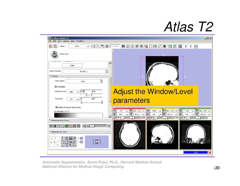 File:AutomaticSegmentation SoniaPujol.pdf