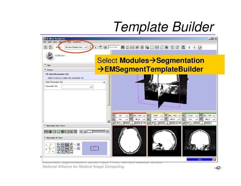File:AutomaticSegmentation SoniaPujol.pdf