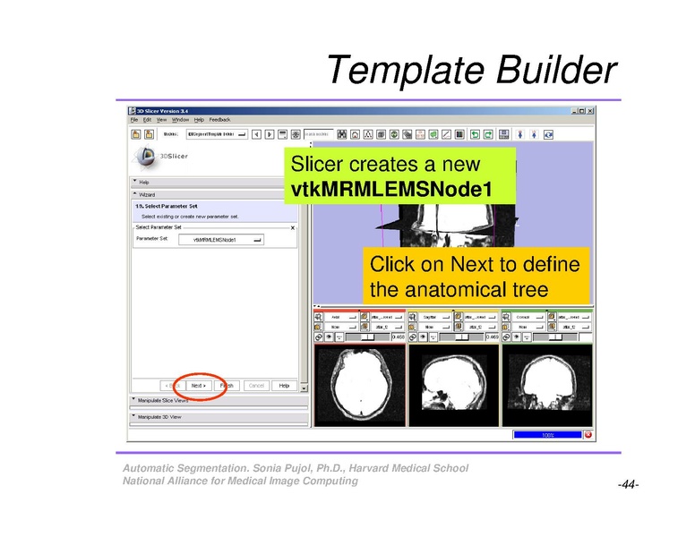 File:AutomaticSegmentation SoniaPujol.pdf