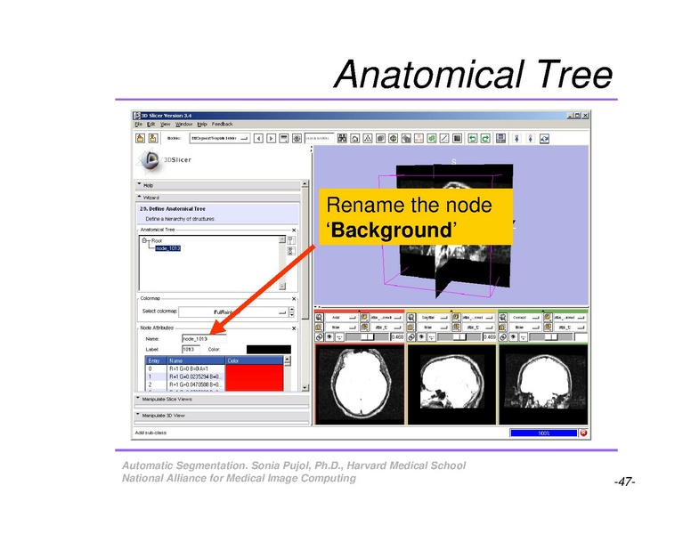 File:AutomaticSegmentation SoniaPujol.pdf