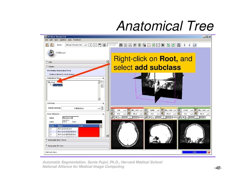 File:AutomaticSegmentation SoniaPujol.pdf