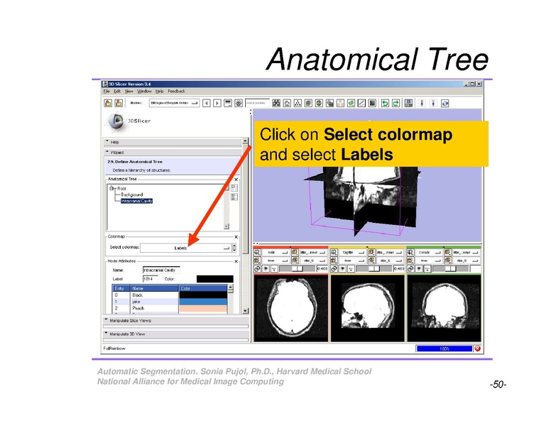 File:AutomaticSegmentation SoniaPujol.pdf