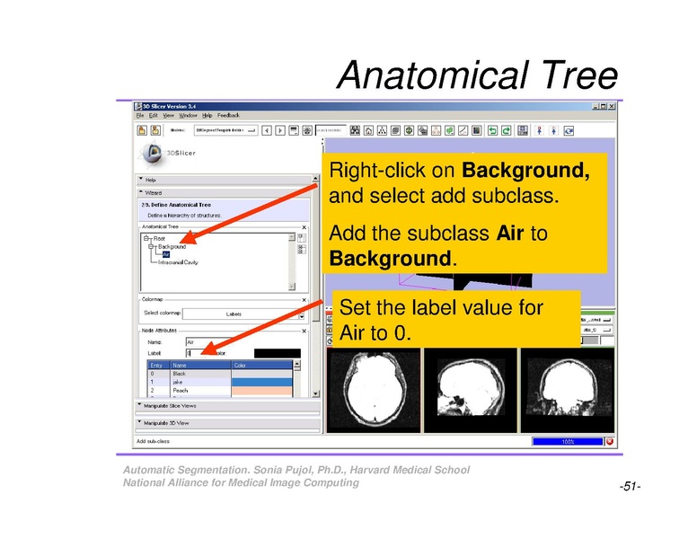 File:AutomaticSegmentation SoniaPujol.pdf
