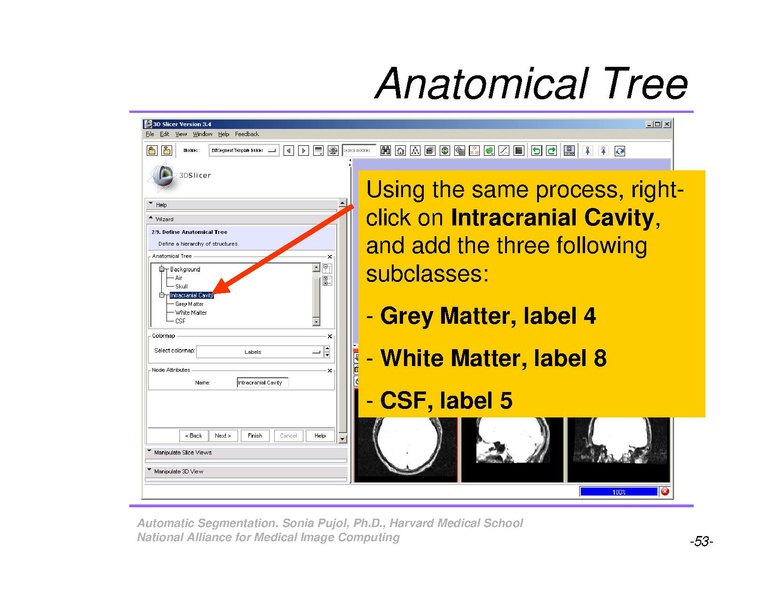 File:AutomaticSegmentation SoniaPujol.pdf